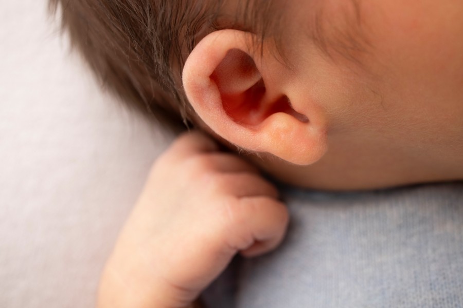 Quelles sont les causes de l'oreille décollée chez les bébés ?