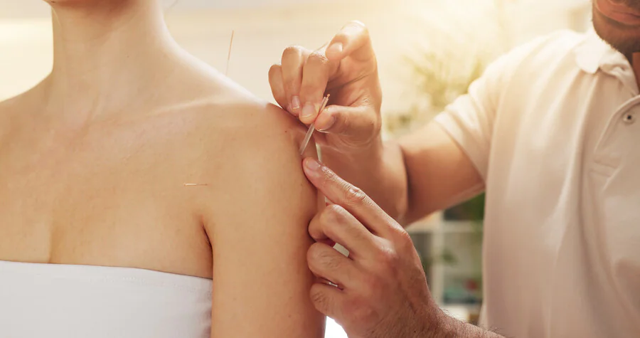 Quelles sont les techniques d'acupuncture les plus efficaces pour traiter le stress ?